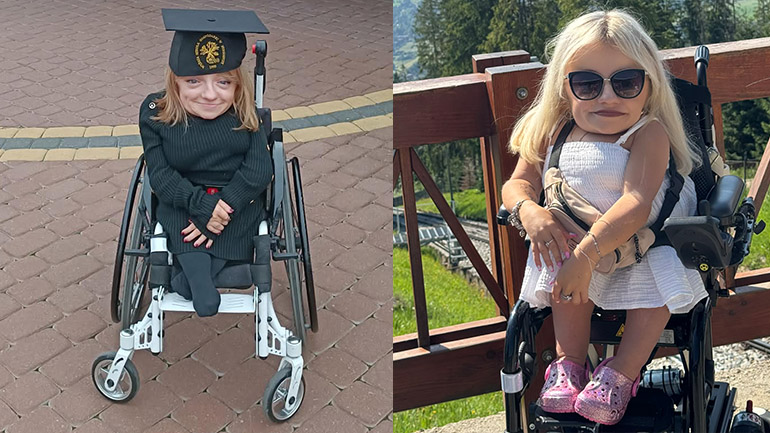 Moje kości są kruche, ale chcę żyć pełnią życia!